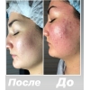 Косметолог, чистка лица