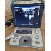 Узи аппарат Toshiba Aplio 400 - экспертный сканер.